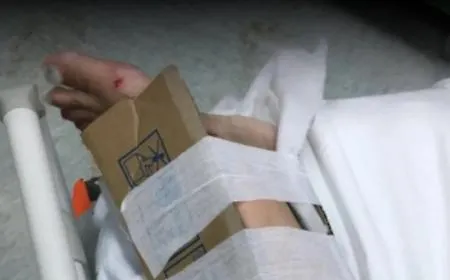 Annullata la multa alla dottoressa che aveva immobilizzato una caviglia con un cartone